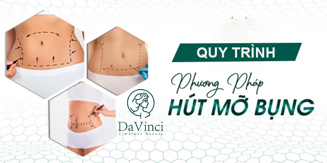 Hút mỡ bụng không phẫu thuật là gì? Hút mỡ bụng có an toàn không?