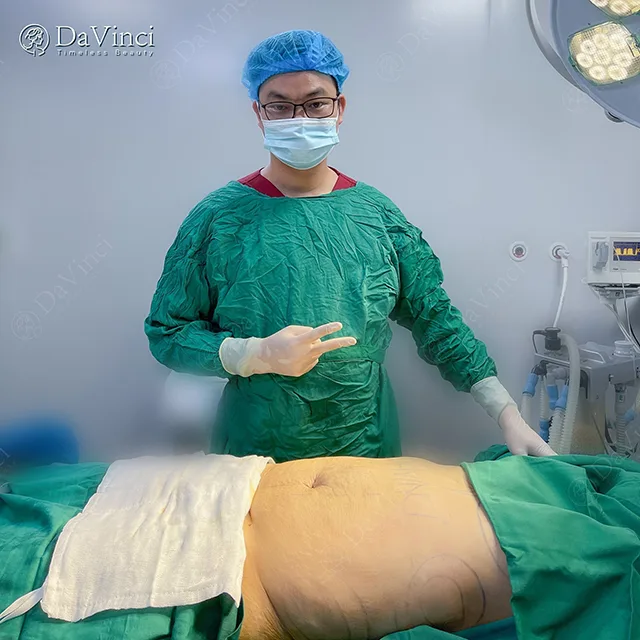 Hút mỡ bụng không phẫu thuật là gì? Hút mỡ bụng có an toàn không?