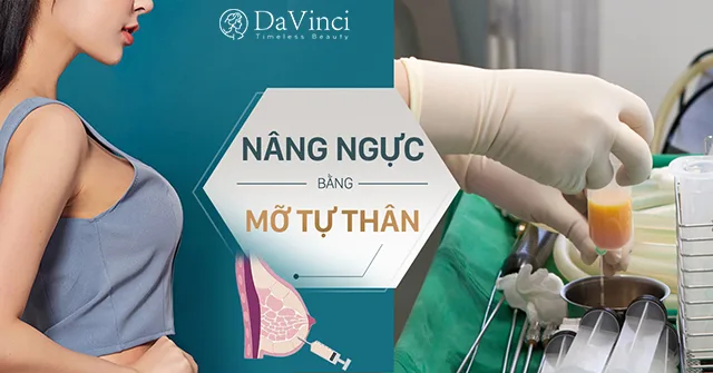 Nâng ngực bằng mỡ tự thân là gì? Review nâng ngực bằng mỡ tự thân
