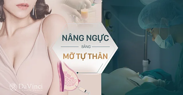 Nâng ngực bằng mỡ tự thân là gì? Review nâng ngực bằng mỡ tự thân