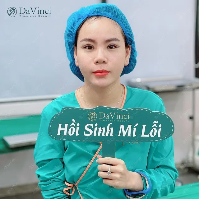 Chỉnh sửa mí lỗi hỏng, trợn sâu sau phẫu thuật đẹp tự nhiên an toàn