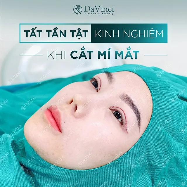 Chỉnh sửa mí lỗi hỏng, trợn sâu sau phẫu thuật đẹp tự nhiên an toàn