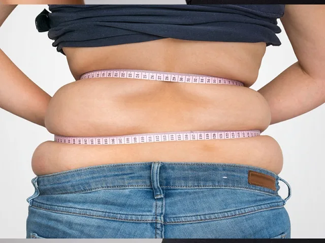 Hút mỡ lưng ở đâu tốt đẹp tự nhiên? Hút mỡ lưng giá bao nhiêu?
