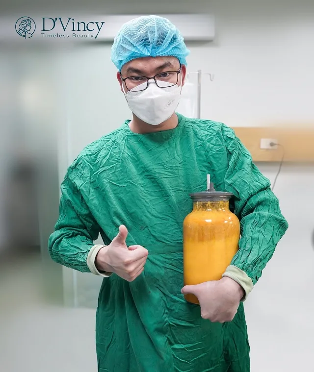 Hút mỡ lưng ở đâu tốt đẹp tự nhiên? Hút mỡ lưng giá bao nhiêu?