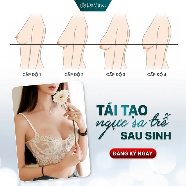 Nâng ngực chảy xệ có đau không? Cách chăm sóc sau nâng ngực
