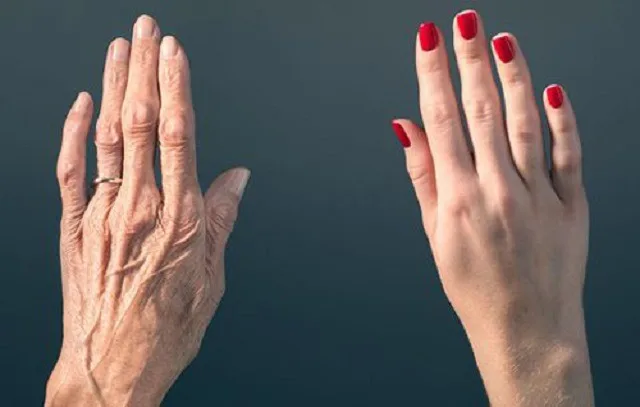 Cấy mỡ mu bàn tay giá bao nhiêu? Ở đâu an toàn uy tín ? Cấy mỡ mu bàn tay giá bao nhiêu? Ở đâu an toàn uy tín ?