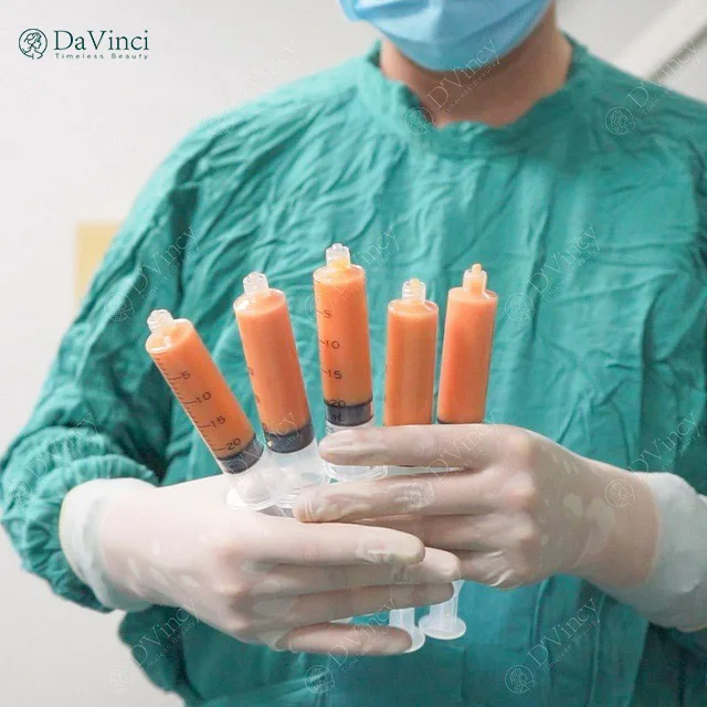 Cấy mỡ mu bàn tay giá bao nhiêu? Ở đâu an toàn uy tín ? Cấy mỡ mu bàn tay giá bao nhiêu? Ở đâu an toàn uy tín ?