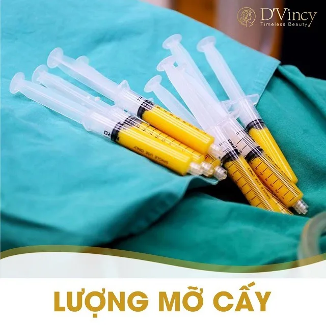 Cấy mỡ thái dương giá bao nhiêu? Có đau và nguy hiểm không? 