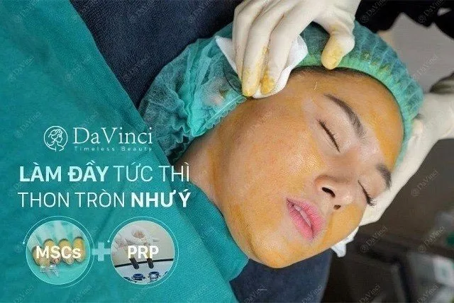 Cấy mỡ thái dương giá bao nhiêu? Có đau và nguy hiểm không? 