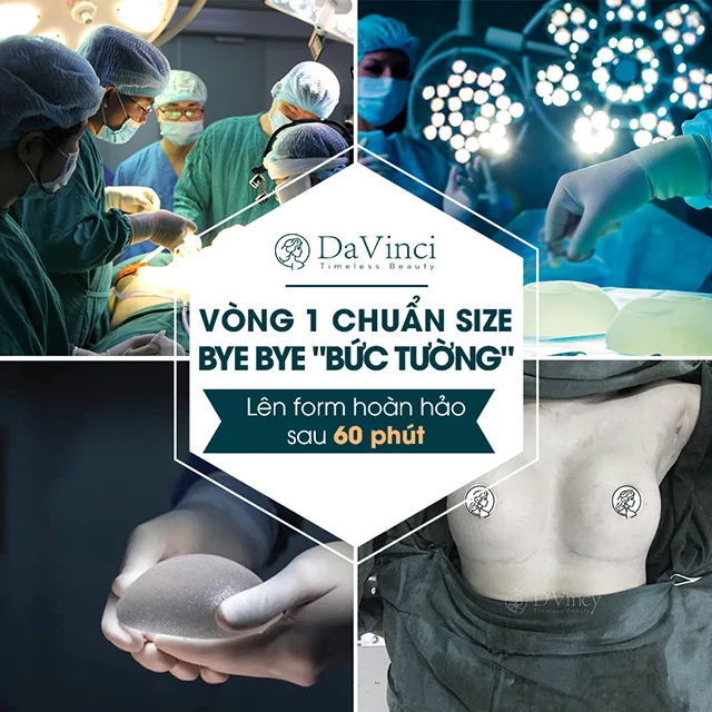 Nâng ngực Hybrid giá bao nhiêu? Có duy trì được lâu ? Nâng ngực Hybrid giá bao nhiêu? Có duy trì được lâu ?