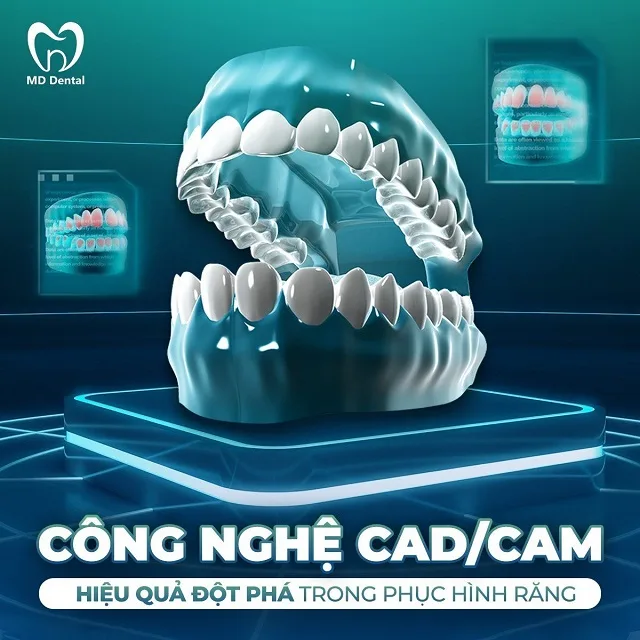 Bọc răng sứ giá bao nhiêu? Đối tượng và quy trình bọc răng sứ