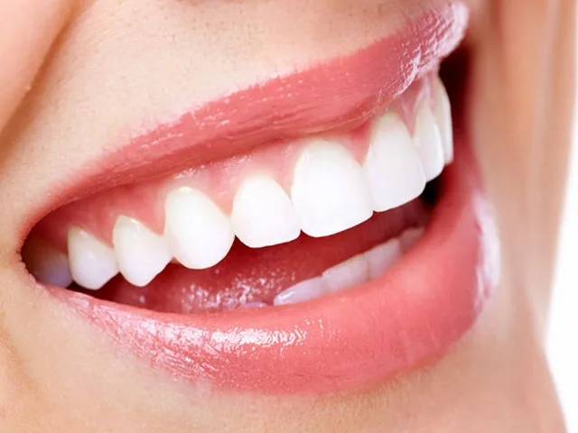 Dán sứ Veneer giá bao nhiêu? Dán sứ Veneer có bền không?