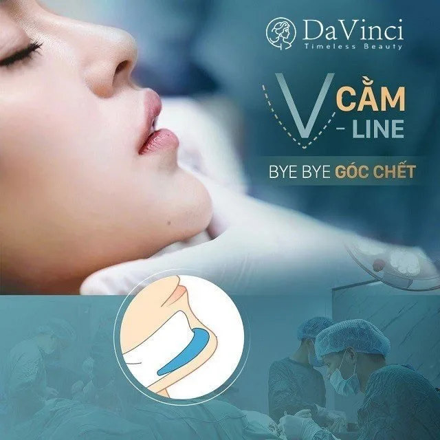 Độn cằm Vline Hàn Quốc có tốt không? Độn cằm Vline ở đâu uy tín? Độn cằm Vline Hàn Quốc có tốt không? Độn cằm Vline ở đâu uy tín?