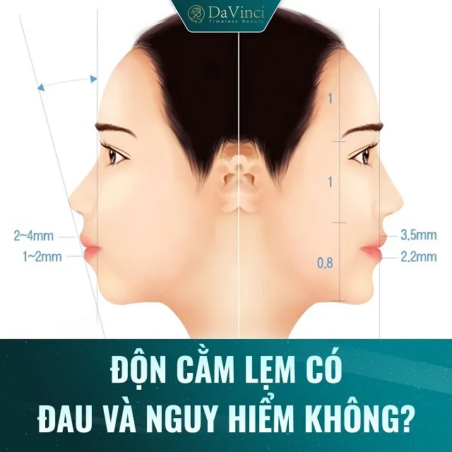 Độn cằm lẹm ngắn lệch giá bao nhiêu? Ở đâu uy tín an toàn nhất? 