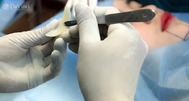 Độn cằm lẹm ngắn lệch giá bao nhiêu? Ở đâu uy tín an toàn nhất? 