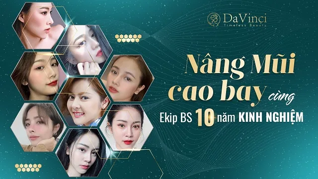 Nâng mũi cao bay có ốt không? Nâng mũi cao bay bao nhiêu tiền?