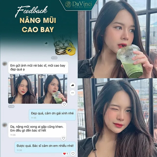 Nâng mũi cao bay có ốt không? Nâng mũi cao bay bao nhiêu tiền?