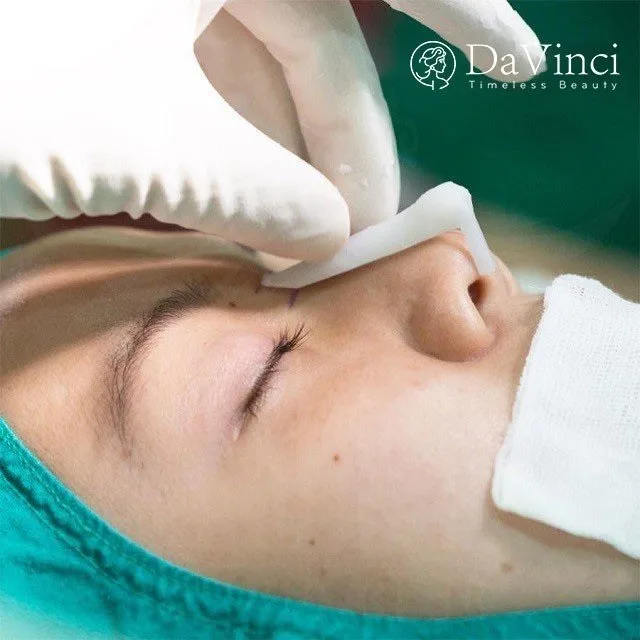 Sửa mũi bị lỗi hỏng ở đâu an toàn uy tín tại Hà Nội và TP Hồ Chí Minh