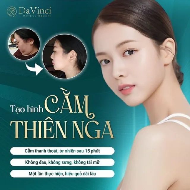 Tạo hình cằm thiên nga là gì? Tạo hình cằm thiên nga có tốt không? Tạo hình cằm thiên nga là gì? Tạo hình cằm thiên nga có tốt không?