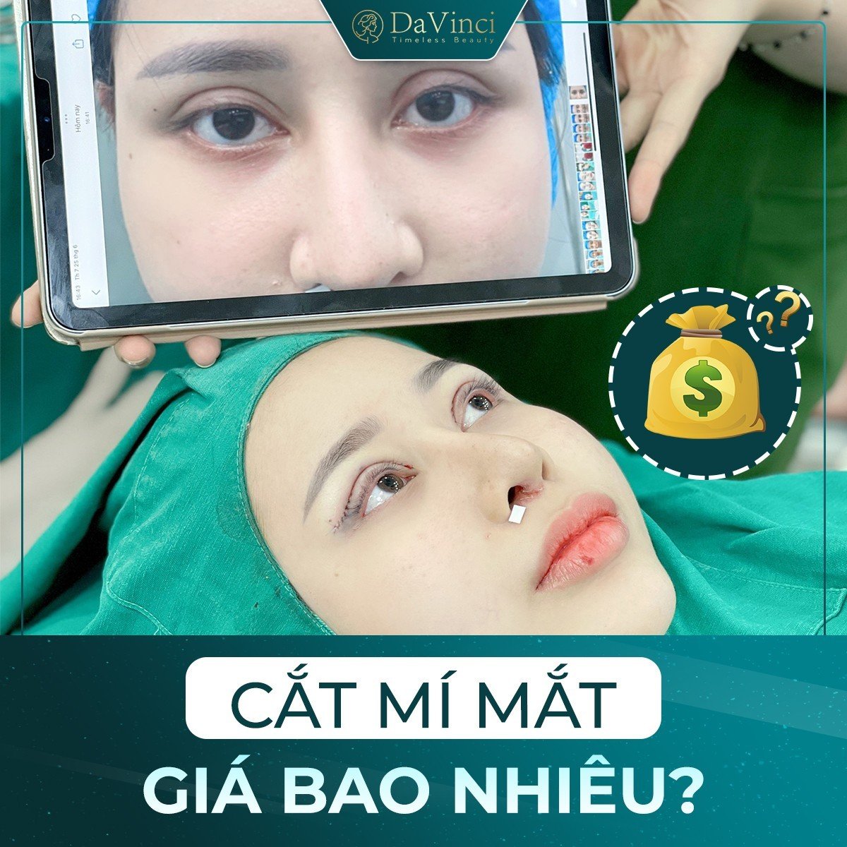 Bảng giá thẩm mỹ viện Davinci mới nhất hiện nay 2023