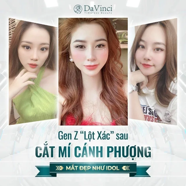 Cắt mí mắt ăn gì cho mau lành? Bí quyết hồi phục nhanh chóng Cắt mí mắt ăn gì cho mau lành? Bí quyết hồi phục nhanh chóng
