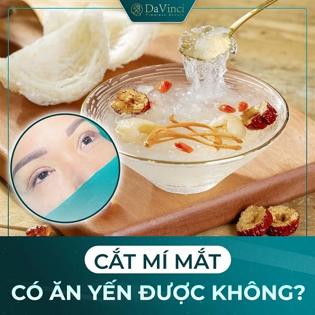 Cắt mí mắt có ăn yến được không? Những lưu ý khi ăn yến sào