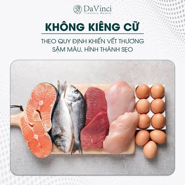 Cắt mí mắt xong bị ngứa nên làm gì? Cắt mí mắt xong bị ngứa nên làm gì?
