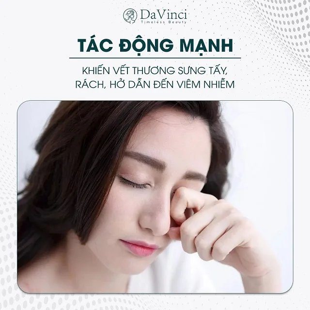 Cắt mí bao lâu hết sưng, lành đẹp tự nhiên? 