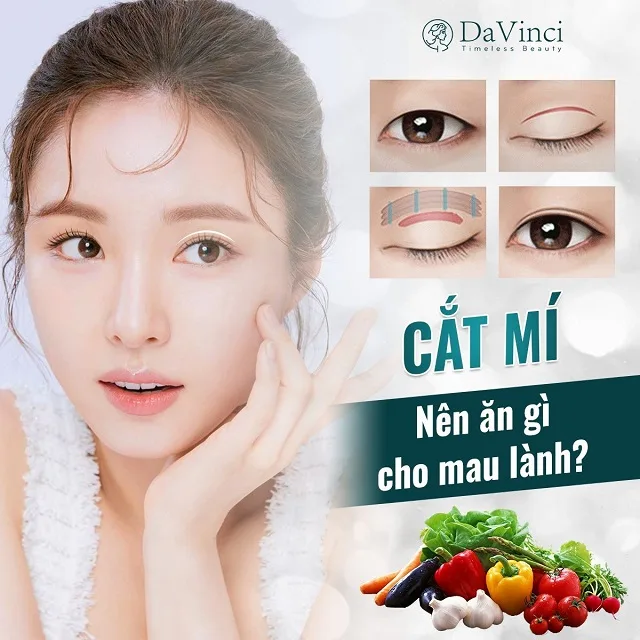 Cắt mí mắt có để lại sẹo không? Chia sẻ cách tránh sẹo sau khi cắt mí mắt?