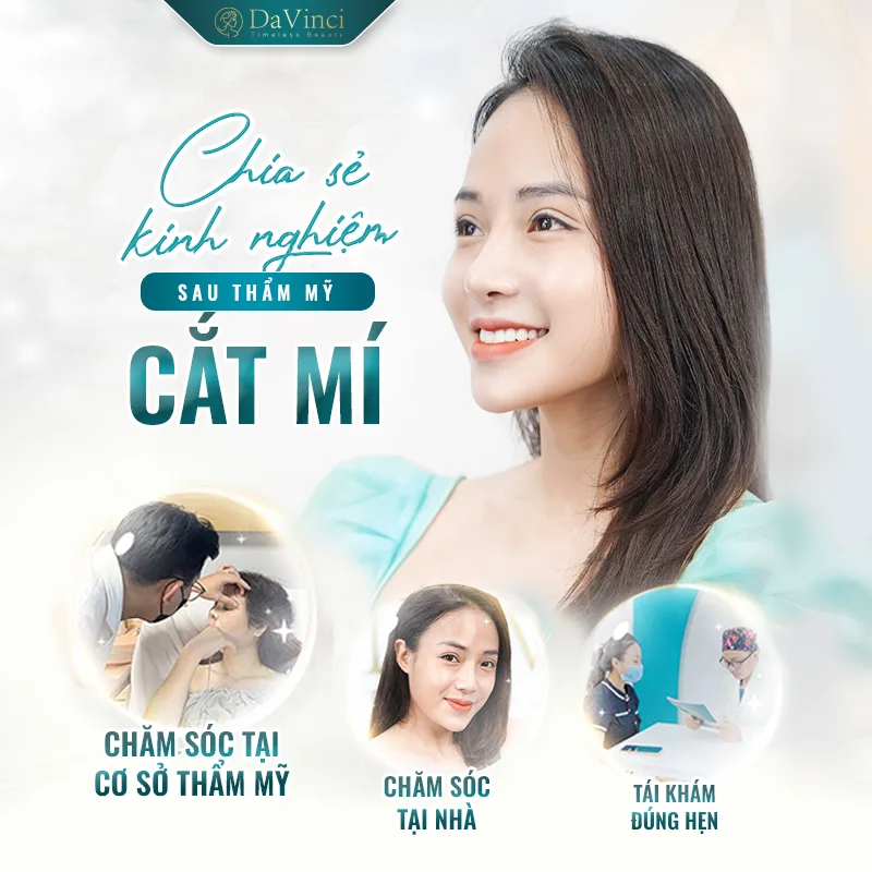 Kinh nghiệm cắt mí mắt: Chia sẻ Trước- Trong- Sau thẩm mỹ Kinh nghiệm cắt mí mắt: Chia sẻ Trước- Trong- Sau thẩm mỹ