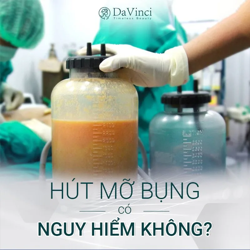 Hút mỡ bụng có nguy hiểm không? Hút mỡ bụng có đau không? Hút mỡ bụng có nguy hiểm không? Hút mỡ bụng có đau không?