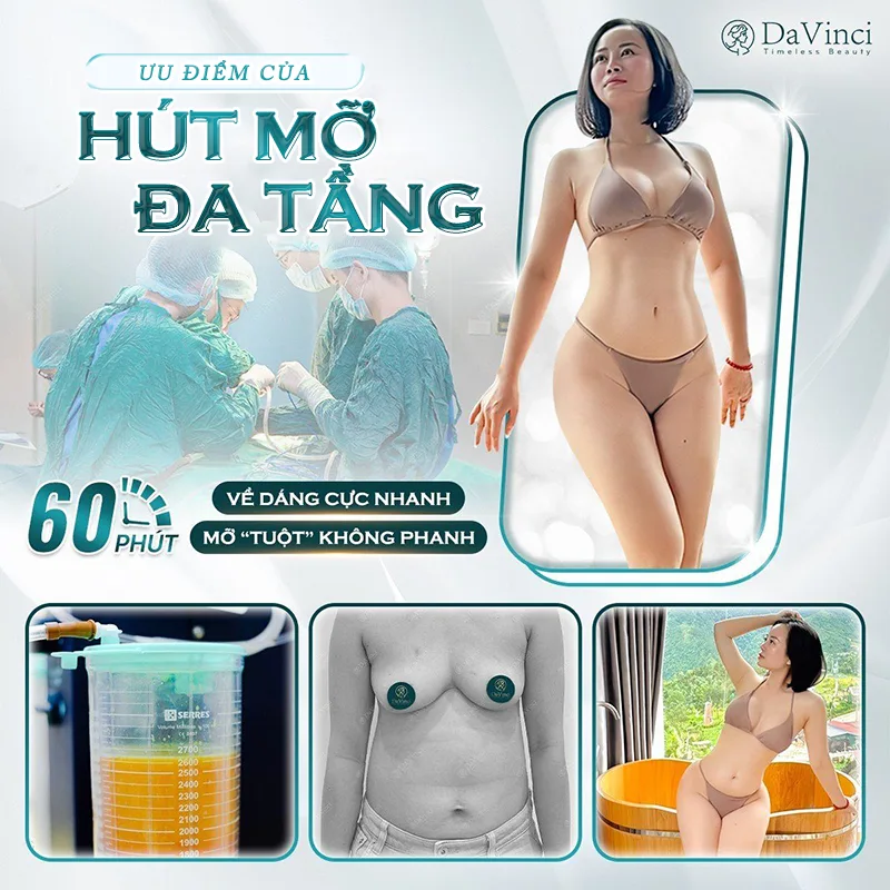 Hút mỡ đa tầng - Công nghệ hút mỡ tân tiến an toàn nhất.