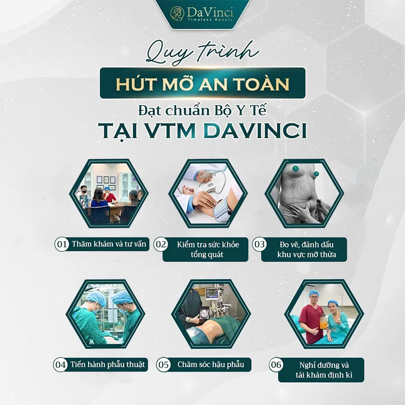 Hút mỡ đa tầng - Công nghệ hút mỡ tân tiến an toàn nhất.