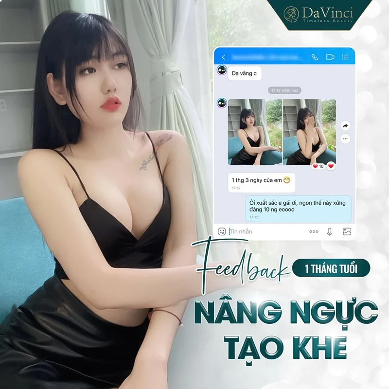 Kinh nghiệm đi nâng ngực hữu ích hội chị em cần ghi nhớ Kinh nghiệm đi nâng ngực hữu ích hội chị em cần ghi nhớ