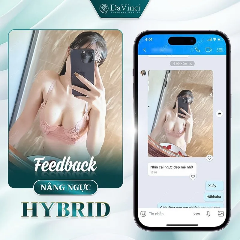 Phương pháp nâng ngực qua đường nào tốt nhất hiện nay? Phương pháp nâng ngực qua đường nào tốt nhất hiện nay?