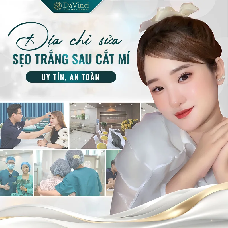 Cắt mí bị sẹo trắng: Nguyên nhân và giải pháp khắc phục hiệu quả