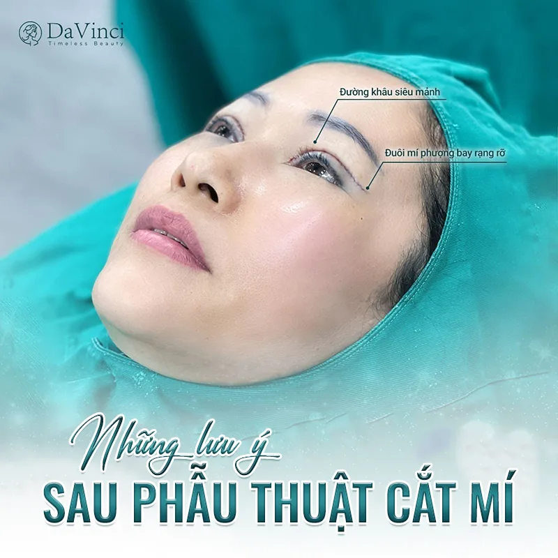 Cắt mí mắt uống nước dừa được không? Cắt mí mắt uống nước dừa được không?