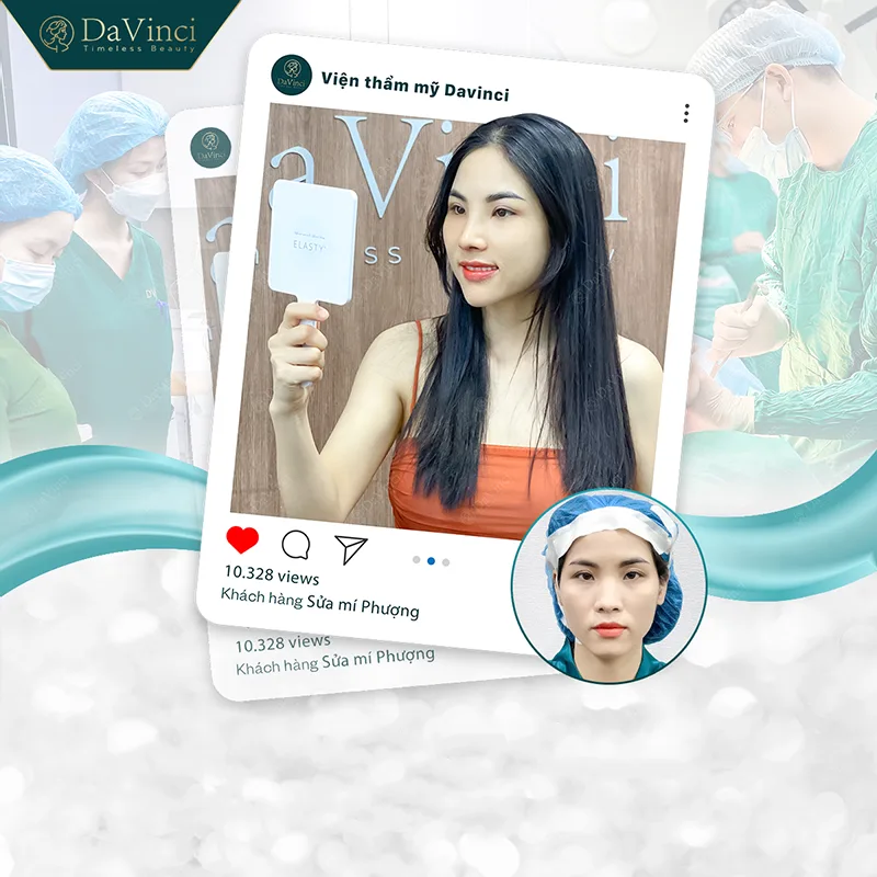 Cắt mí mắt uống nước dừa được không? Cắt mí mắt uống nước dừa được không?