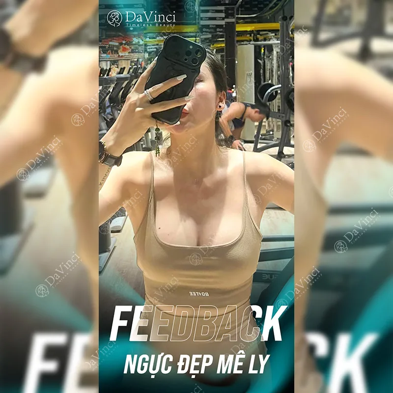 Nâng ngực hình giọt nước là gì? Giá bao nhiêu? Loại nào tốt? Nâng ngực hình giọt nước là gì? Giá bao nhiêu? Loại nào tốt?