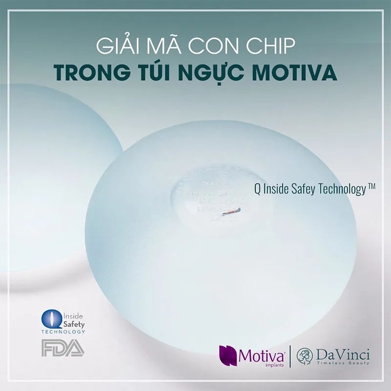 Túi ngực Motiva có tốt không? Giá bao nhiêu? Của nước nào? Túi ngực Motiva có tốt không? Giá bao nhiêu? Của nước nào?