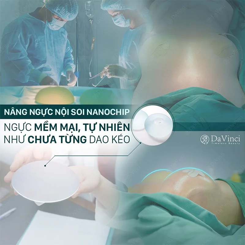 Túi ngực Motiva có tốt không? Giá bao nhiêu? Của nước nào? Túi ngực Motiva có tốt không? Giá bao nhiêu? Của nước nào?