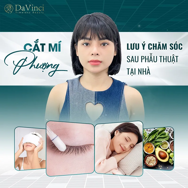 Cắt mí mắt có ăn được ốc không? Sau bao lâu thì ăn được? Cắt mí mắt có ăn được ốc không? Sau bao lâu thì ăn được?