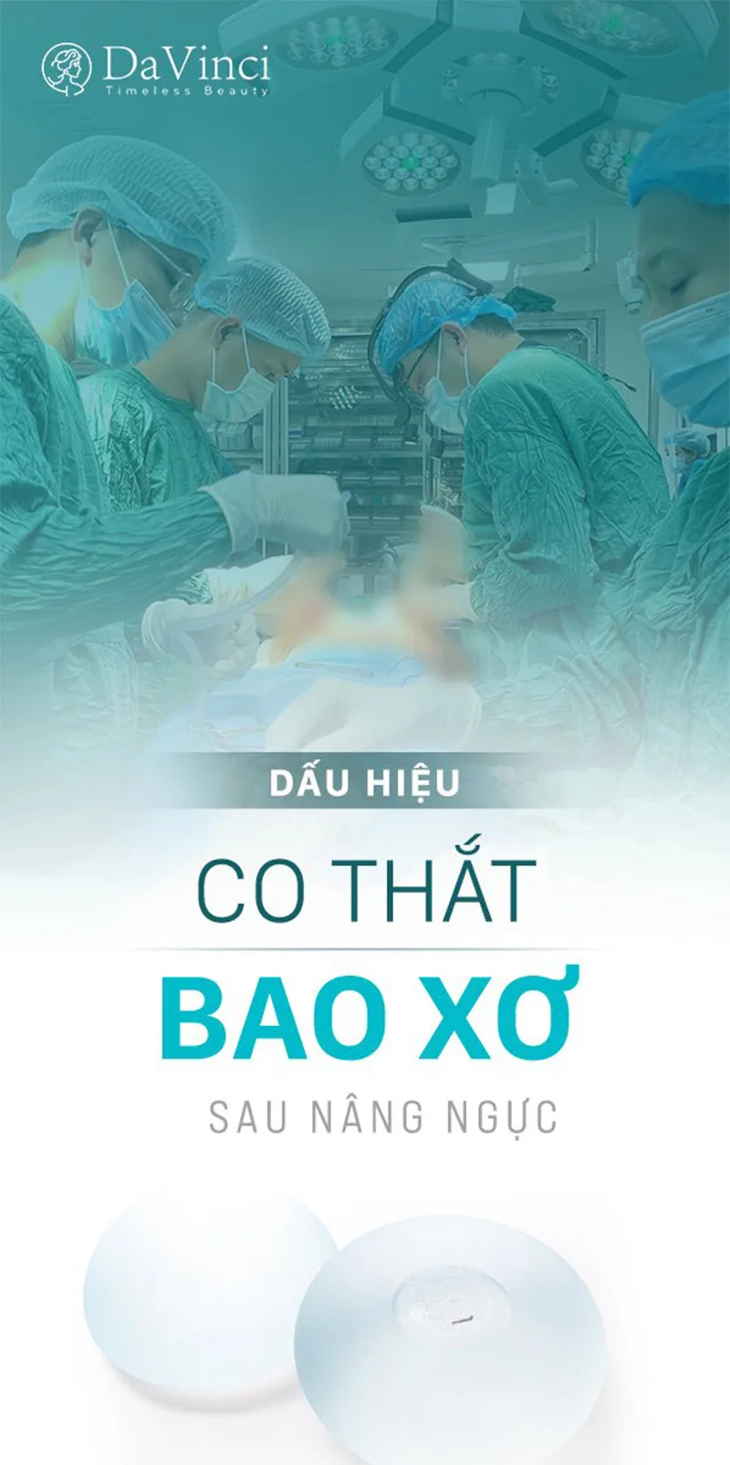 Nâng Ngực Bao Xơ Là Gì? Những Điều Cần Biết Để Phòng Tránh