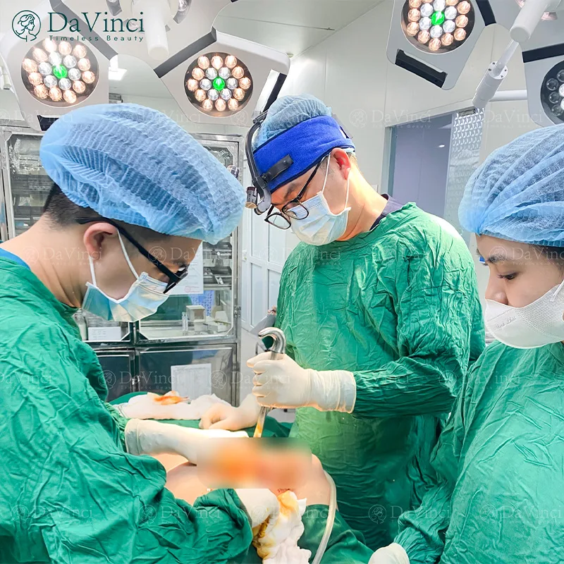 Nâng Ngực Bao Xơ Là Gì? Những Điều Cần Biết Để Phòng Tránh