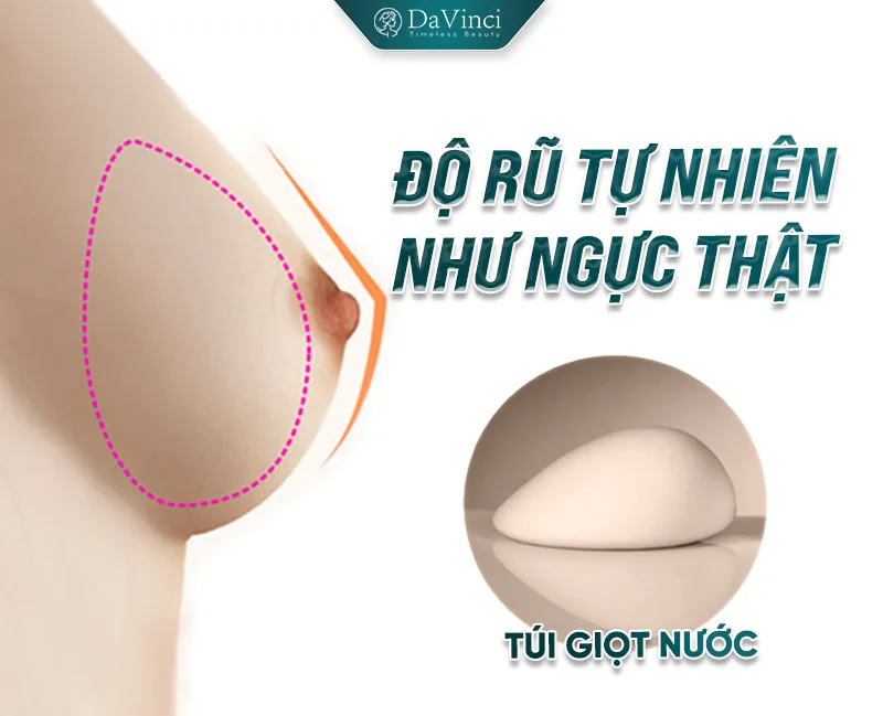Nâng Ngực Túi Tròn Vs Túi Giọt Nước: Cái Nào Tốt Hơn? Nâng Ngực Túi Tròn Vs Túi Giọt Nước: Cái Nào Tốt Hơn?