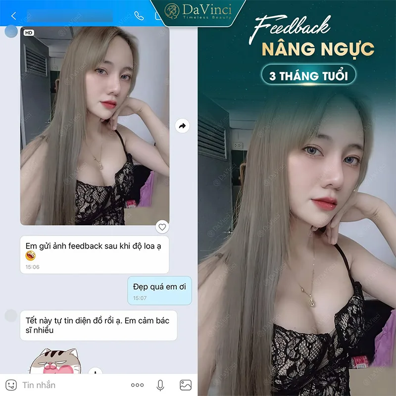 Ngực Lép Có Nên Nâng Ngực Không? Những Lý Do Bạn Nên Xem Xét Ngực Lép Có Nên Nâng Ngực Không? Những Lý Do Bạn Nên Xem Xét