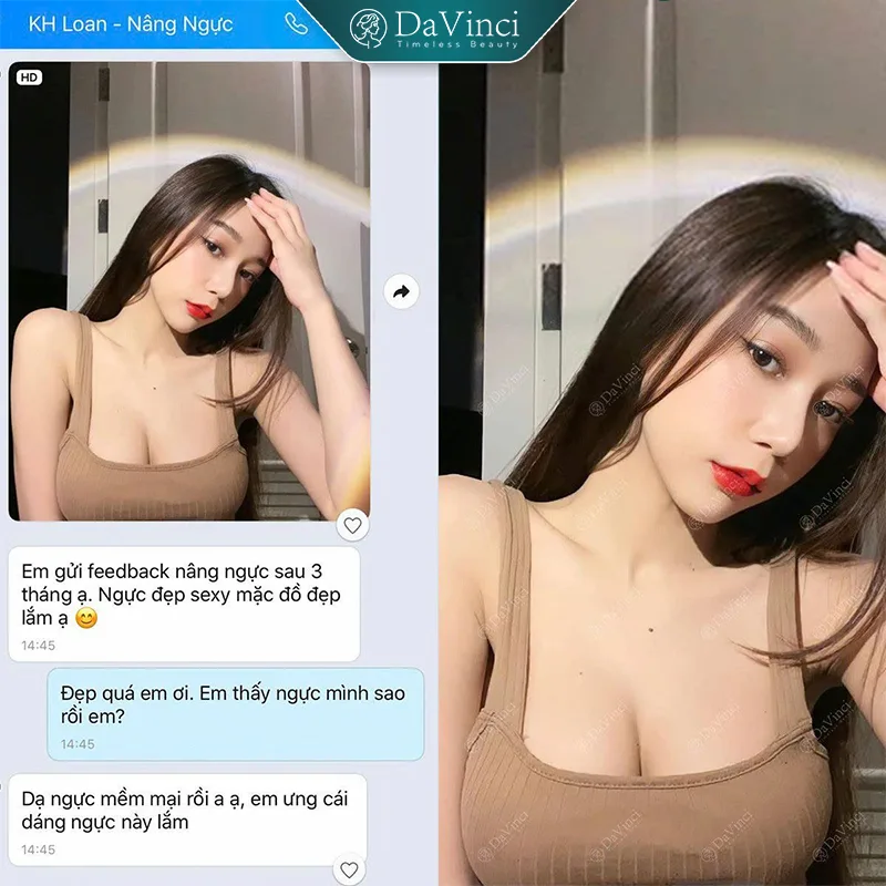 Treo Sa Trễ Đường Quầng Vú: Lợi Ích, Rủi Ro Và Quy Trình Phẫu Thuật Treo Sa Trễ Đường Quầng Vú: Lợi Ích, Rủi Ro Và Quy Trình Phẫu Thuật