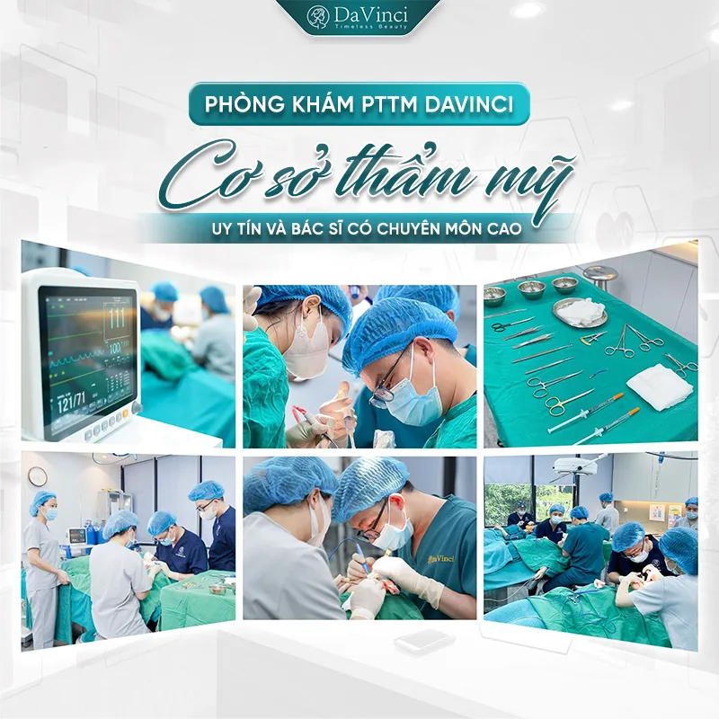 Bao nhiêu tuổi được cắt mí? Tiêu chuẩn độ tuổi & lưu ý quan trọng Bao nhiêu tuổi được cắt mí? Tiêu chuẩn độ tuổi & lưu ý quan trọng