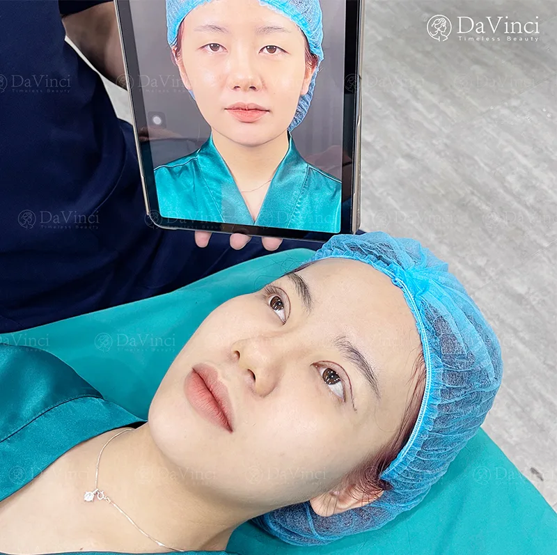Cắt Mí Bao Lâu Thì Được Ăn Thịt Gà? Cách Thực Hiện Đúng Để Hồi Phục Nhanh Cắt Mí Bao Lâu Thì Được Ăn Thịt Gà? Cách Thực Hiện Đúng Để Hồi Phục Nhanh