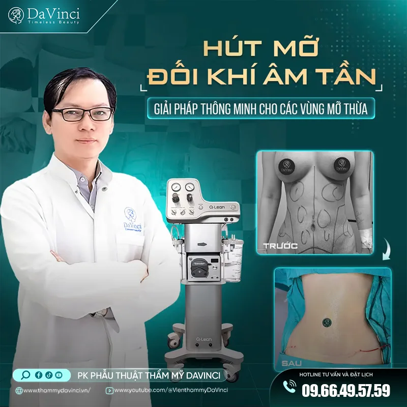Hút mỡ đối khí âm tần